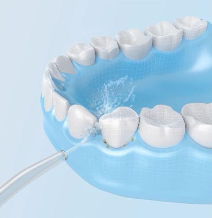 Ирригатор Xiaomi Mijia Electric Flusher (MEO701) Белый Ирригатор Xiaomi Mijia Electric Flusher (MEO701) Белый